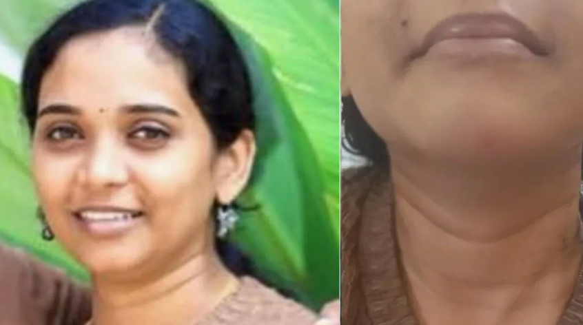 Attukal Bride Death investigation following young woman's death in rented house