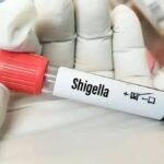 Shigella Health Alert in Thiruvananthapuram with health department prevention measures