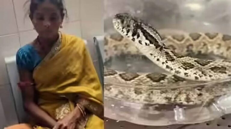 Snake Bite Identification case where woman carried live viper to hospital for treatment