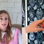 Neurocysticercosis Case showing brain parasite infection diagnosis