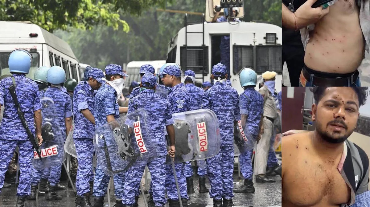 Pellet Gun Explained showing crowd control weapon and public safety discussion