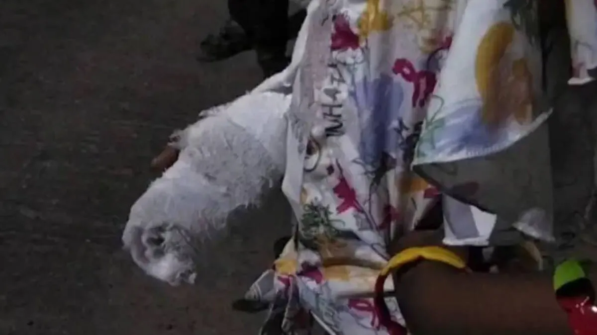 School Assault Complaint involving first standard student with hand plaster in Kerala
